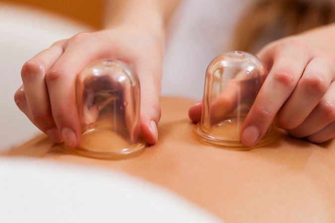 Rückenmassage mit Beauty Cups in der Copa Oase Eine Person liegt mit dem Bauch oberkörperfrei auf einer Liege und bekommt von einer weiteren Person, von der nur die Hände zu sehen sind, durchsichtige Beauty Cups auf den Rücken platziert