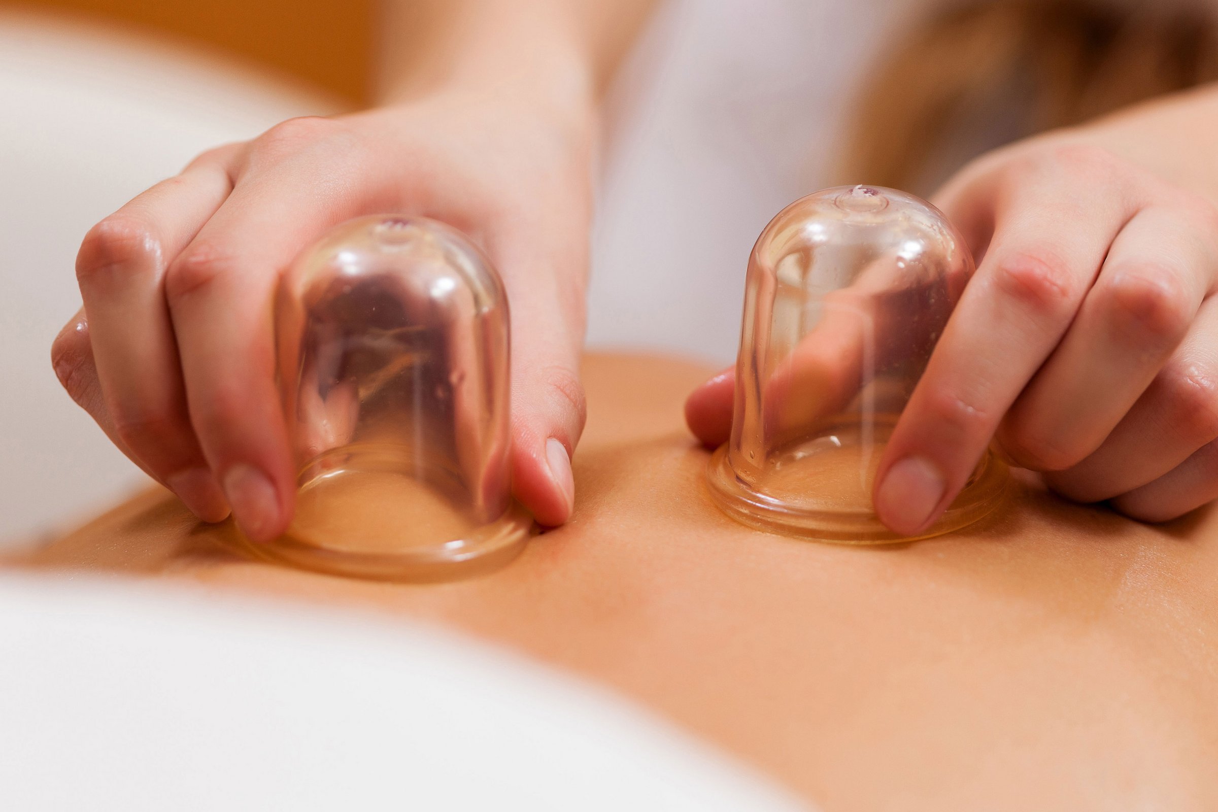 Rückenmassage mit Beauty Cups in der Copa Oase Eine Person liegt mit dem Bauch oberkörperfrei auf einer Liege und bekommt von einer weiteren Person, von der nur die Hände zu sehen sind, durchsichtige Beauty Cups auf den Rücken platziert